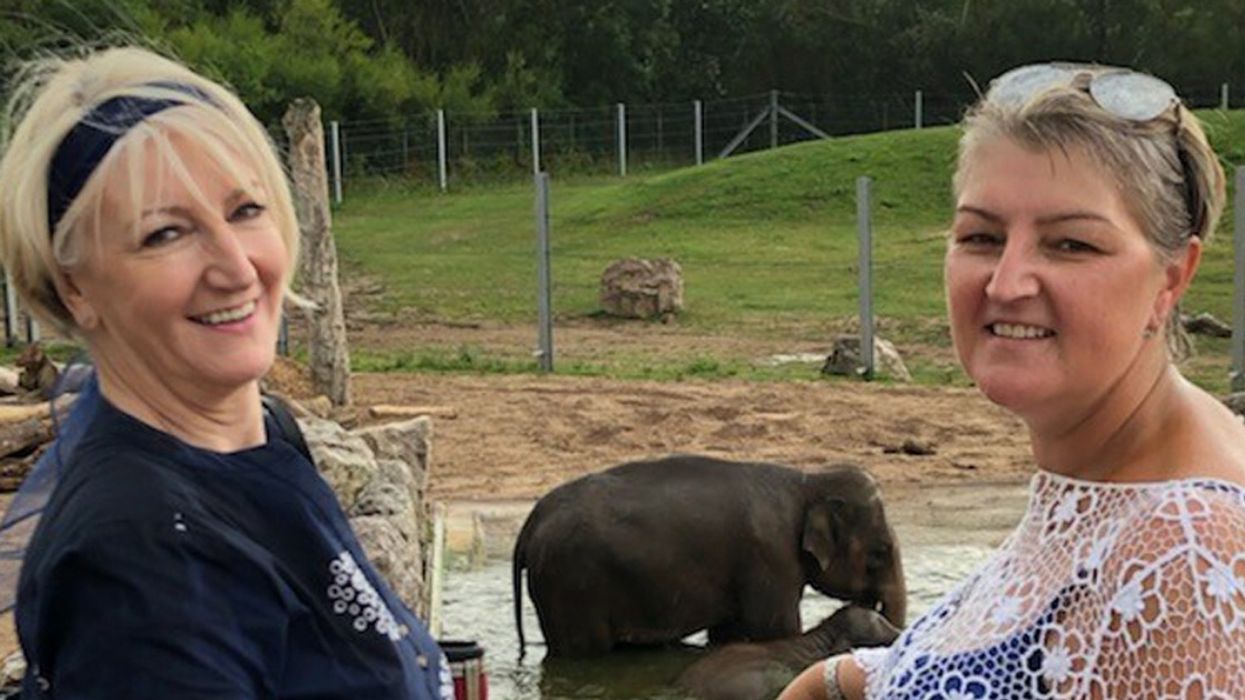 Grandmother Describes Heartache After Brain Aneurysms Turn Adult Daughter Into A 'Grown Up Baby'