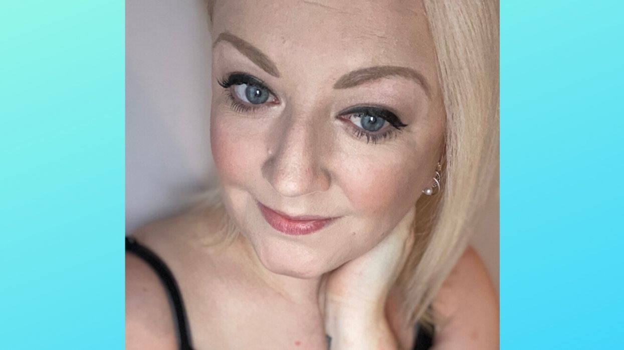 Woman Who Thought She Had Dandruff Diagnosed With Severe Psoriasis That Turned Her Tattoo Into A' Blurry Mess'