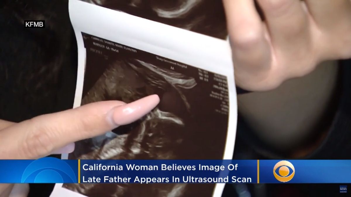 San Diego Mom Convinced Ultrasound Photo Shows Her Late Father Kissing Her Unborn Daughter