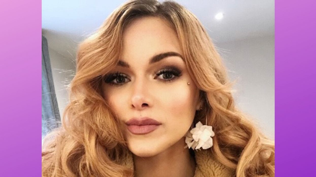 Model Isn't Letting Her Disability Stop Her From Becoming The Next Kate Moss