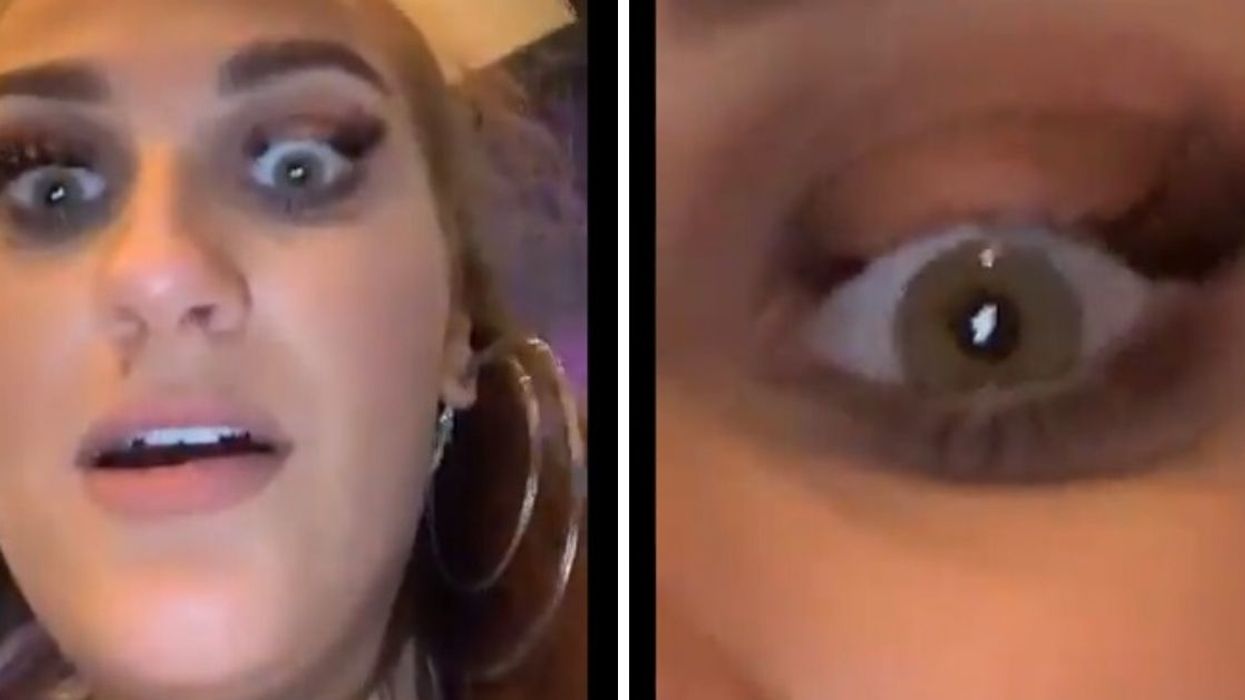 Girl Loses A Chunk Of Her Eyelashes After Whacking Herself In The Face With A Giant Adult Toy