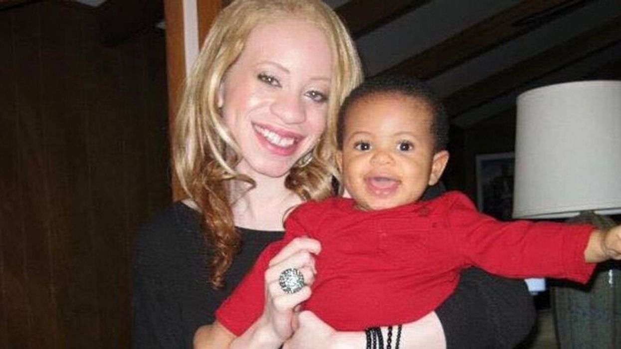 African American Woman Who Faced Merciless Bullying For Her 'Ghostly White' Skin Became 'The First Albino Influencer'