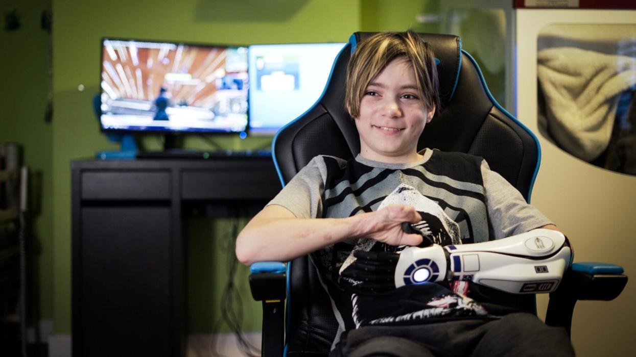 11-Year-Old 'Star Wars' Fan Who Lost Four Limbs To Meningitis Receives R2-D2 Bionic Arm