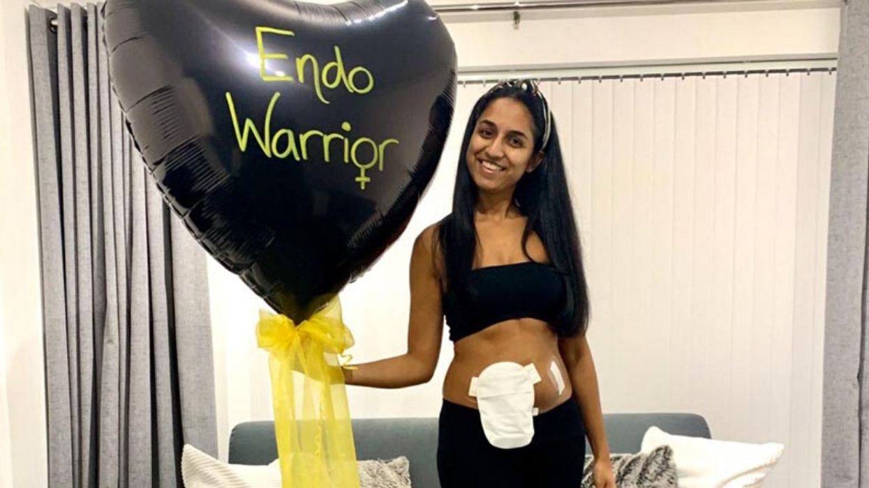 Young Woman Left With Ileostomy Bag After Battle With Endometriosis Finds Her Confidence After Showing It Off Online