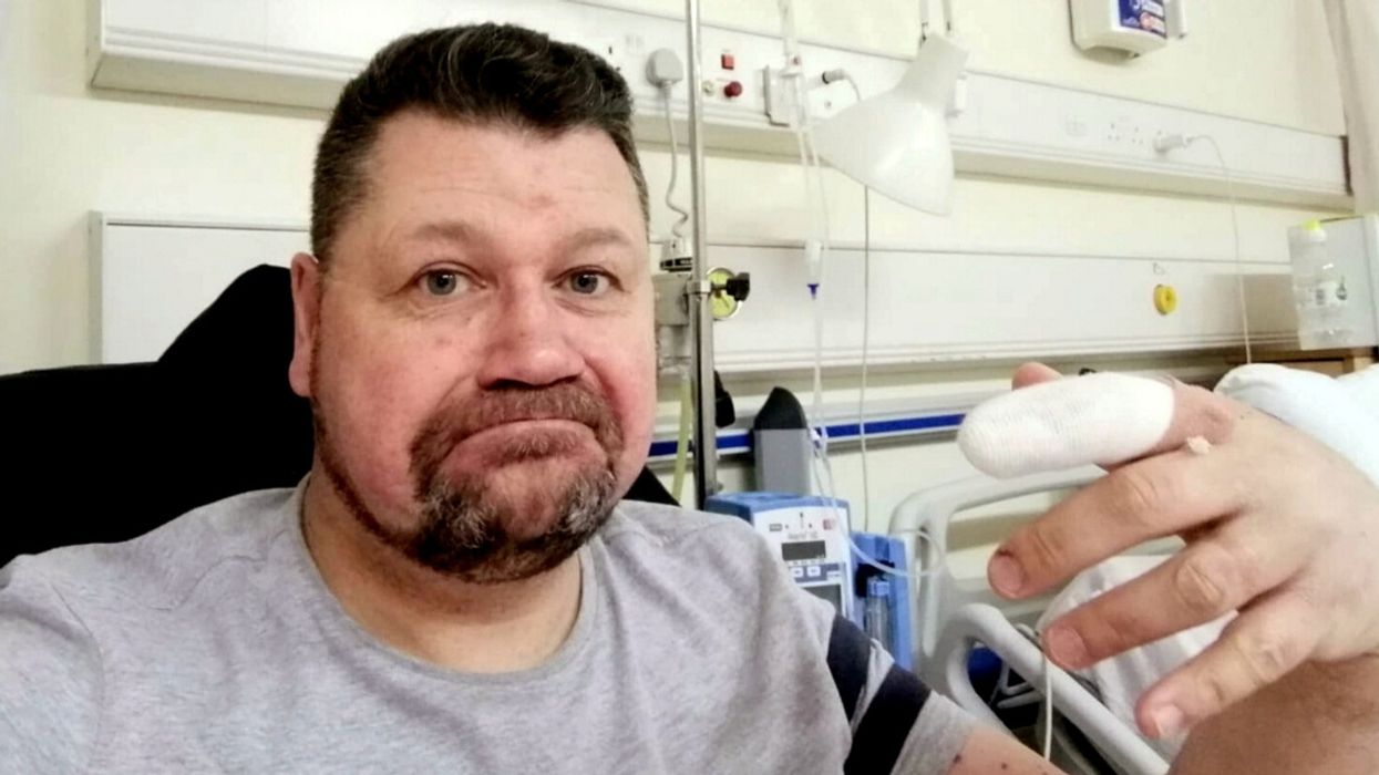 Man Has Warning For Others After His 'Harmless' Nail-Biting Habit Left Him Fighting For His Life