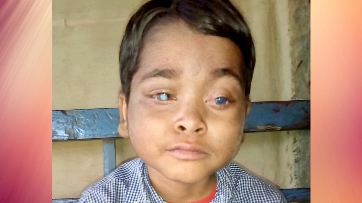 Boy Who Went Blind After His Leukemia Caused His Eyes To Pop Out Gets His Vision Restored Thanks To Kindhearted Stranger