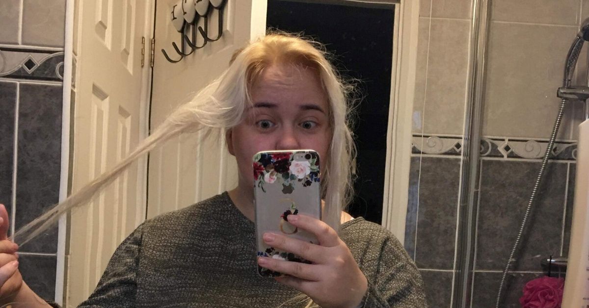 Mother-Of-Two Left Distraught After Drugstore Toner Burns Off 24 Inches Of Her Hair