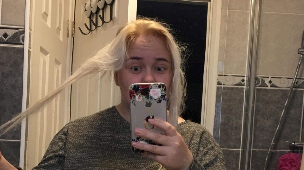 Mother-Of-Two Left Distraught After Drugstore Toner Burns Off 24 Inches Of Her Hair