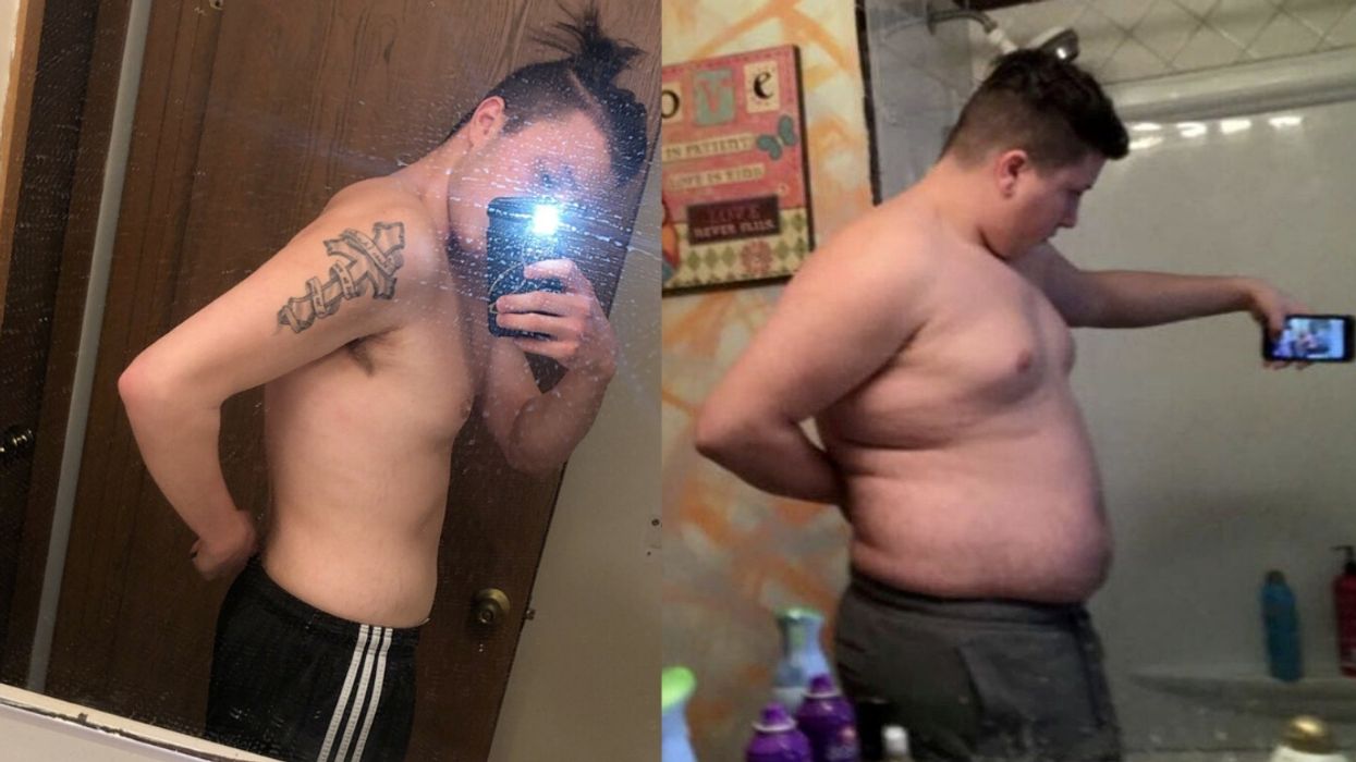 Man Who Would Gorge Junk Food And Then Starve Himself Until He Would 'Pass Out' Opens Up About His Road To Recovery