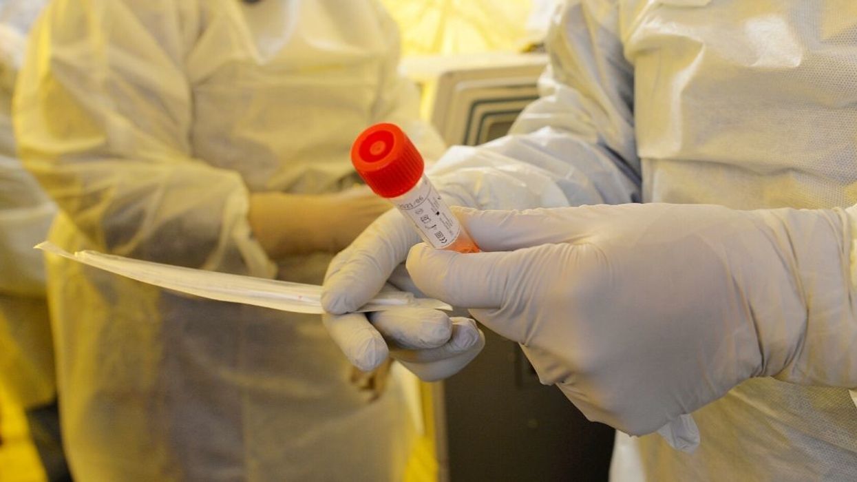 The CDC's Early Coronavirus Tests Reportedly Couldn't Distinguish Between COVID-19 And Water