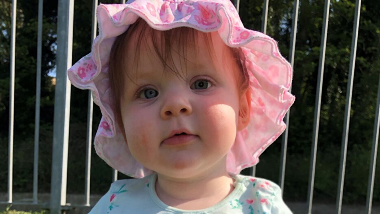 Baby Girl Who Lost An Eye After Camera Flash Exposed Rare Condition Celebrates Her First Birthday
