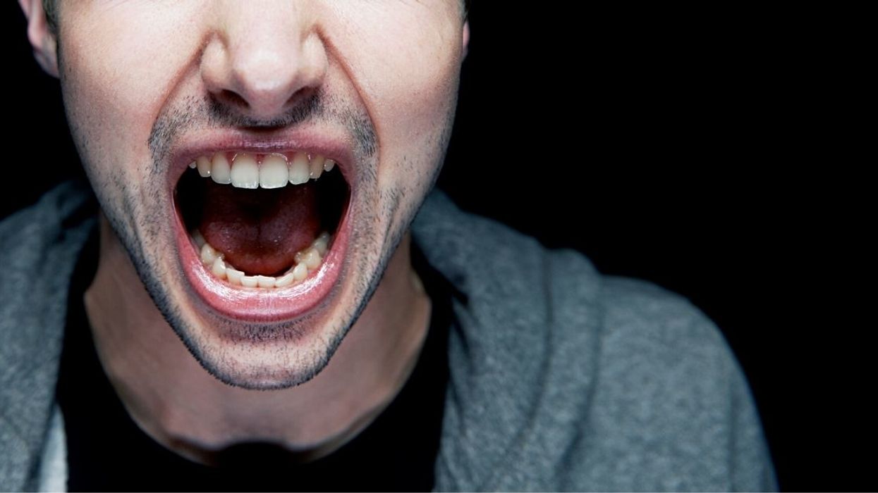 Redditor Sparks Family Drama After Not Allowing Their Non-Verbal Autistic Nephew To Attend Their Wedding