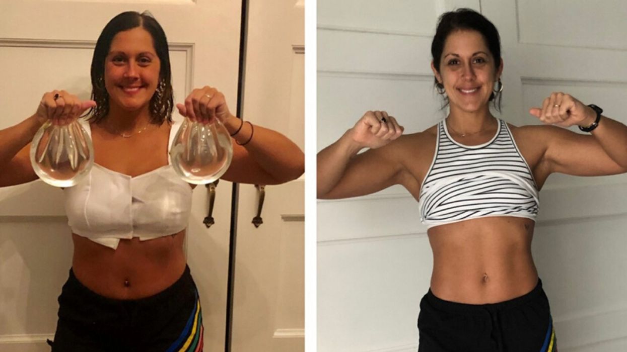 Mom Says DD Implants Caused Such Severe Memory Loss She Was Scared She Had Dementia