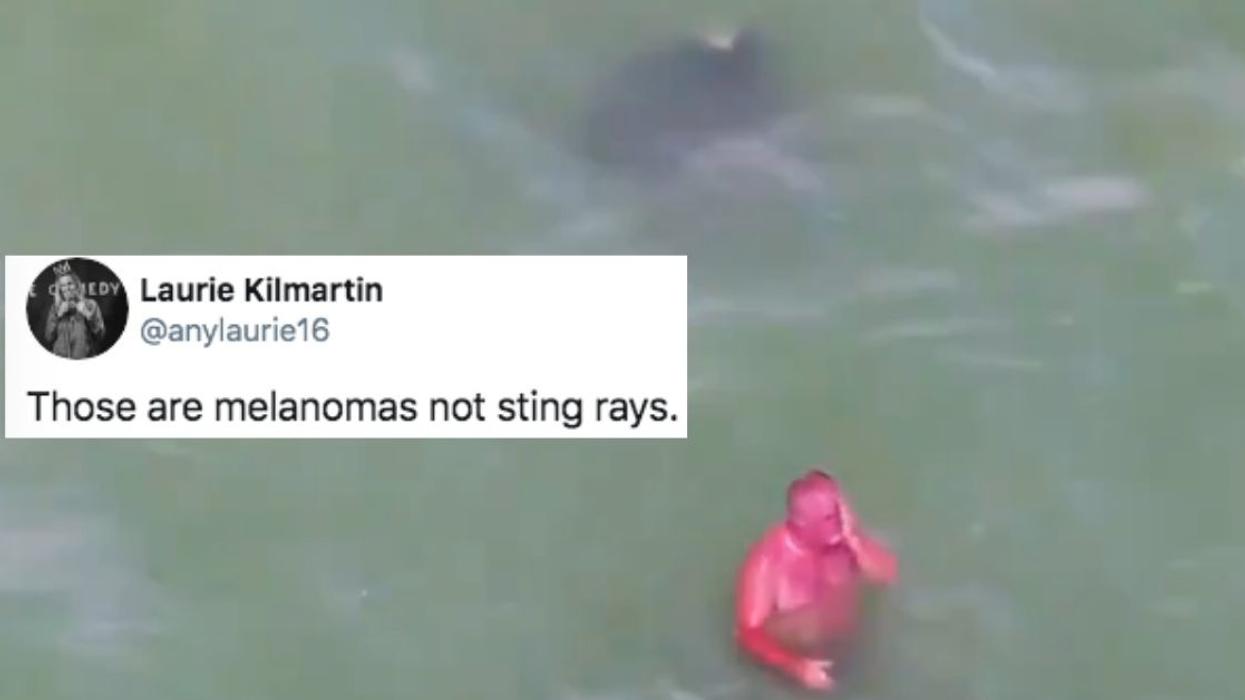 Florida Swimmer Roasted For Looking Like 'Hellboy' After His Horrific Sunburn Inadvertently Goes Viral