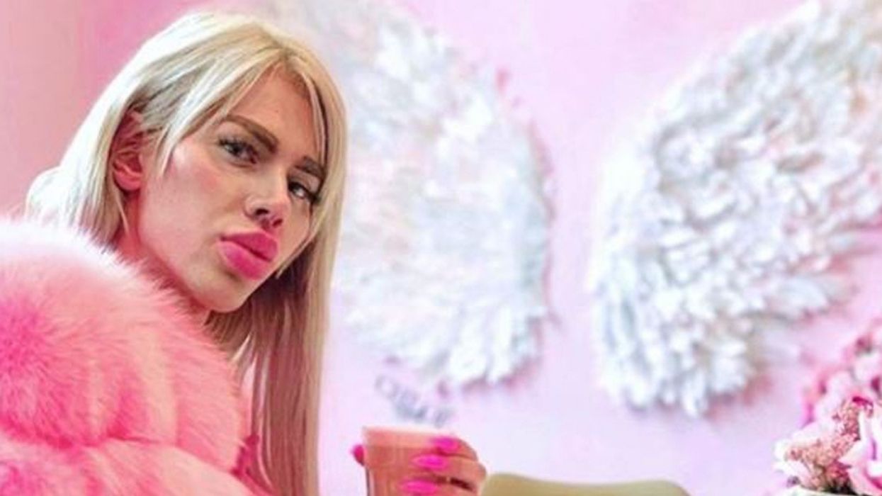 Man Has Nearly $20,000 Worth Of Fillers Injected Into His Face In Quest To 'Look Like Barbie'