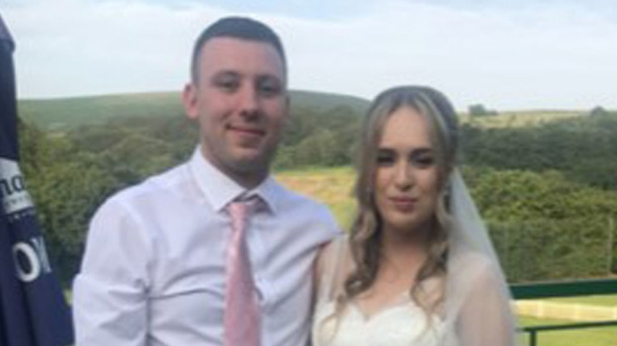 Woman Whose Severe Eczema Landed Her In The Hospital Praises 'Miracle' Ointment For Restoring Her Confidence