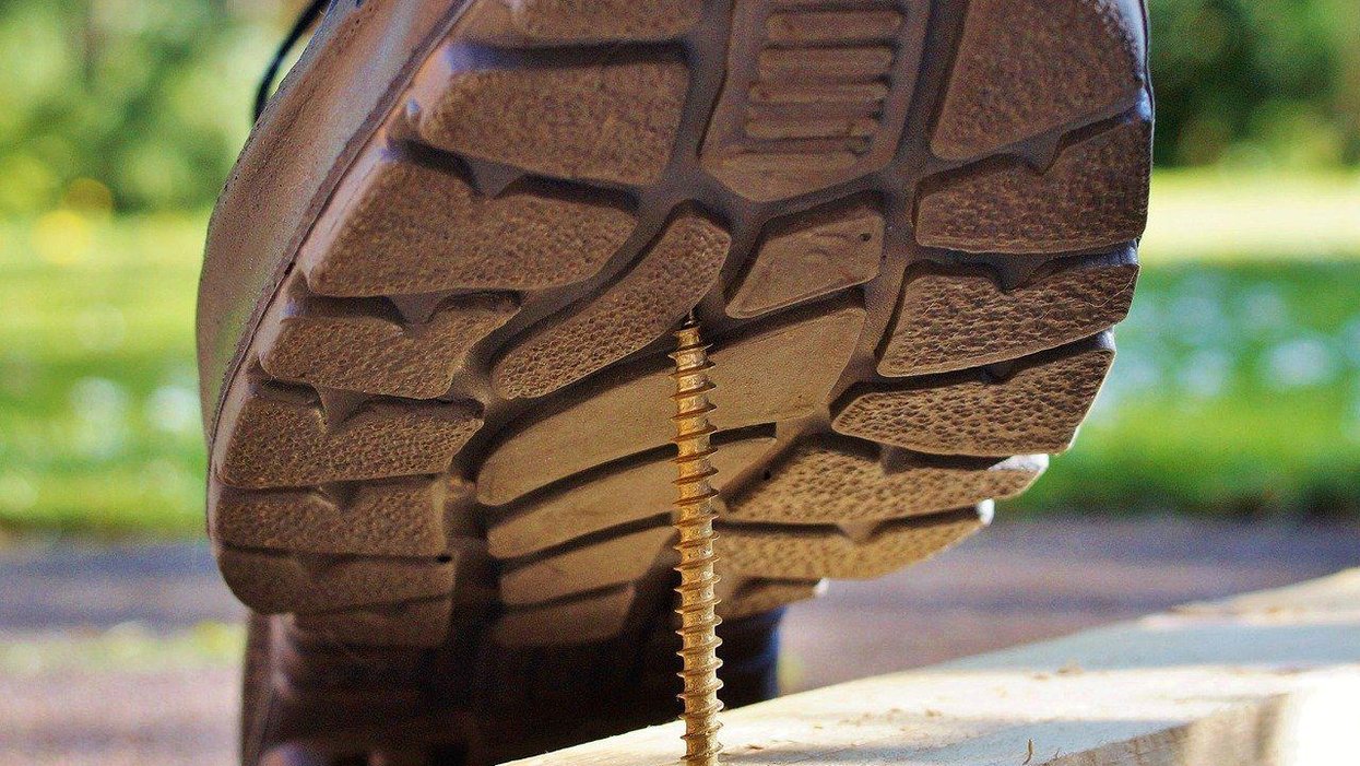 People Describe The Stupidest Self-Inflicted Injury They've Ever Gotten