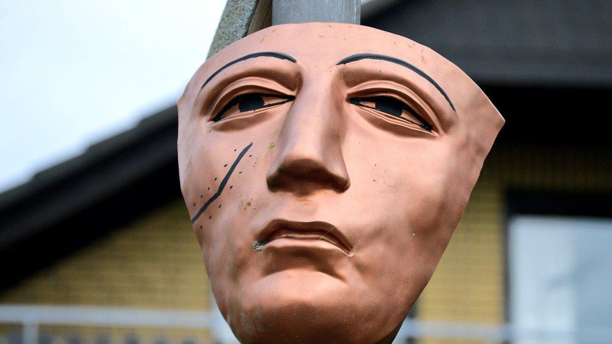 People Describe The Dumbest Way They've Ever Gotten A Scar