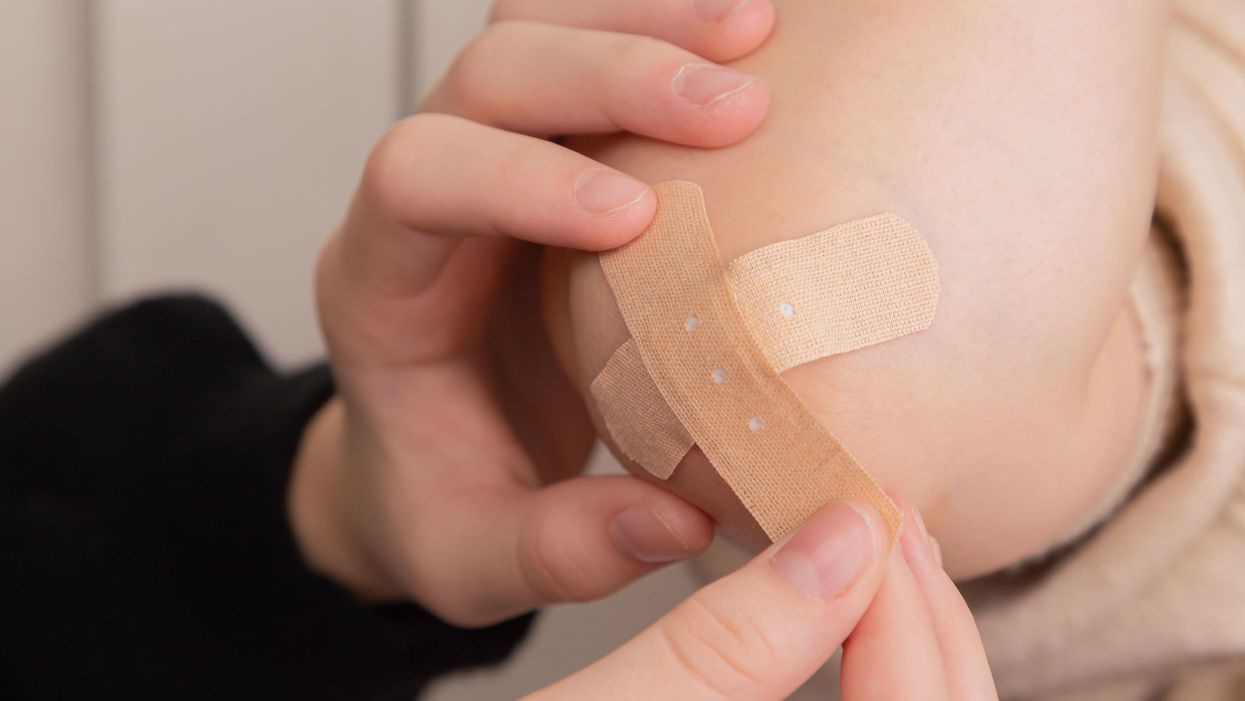 People Share Their Craziest 'But It's Only A Scratch' Experiences