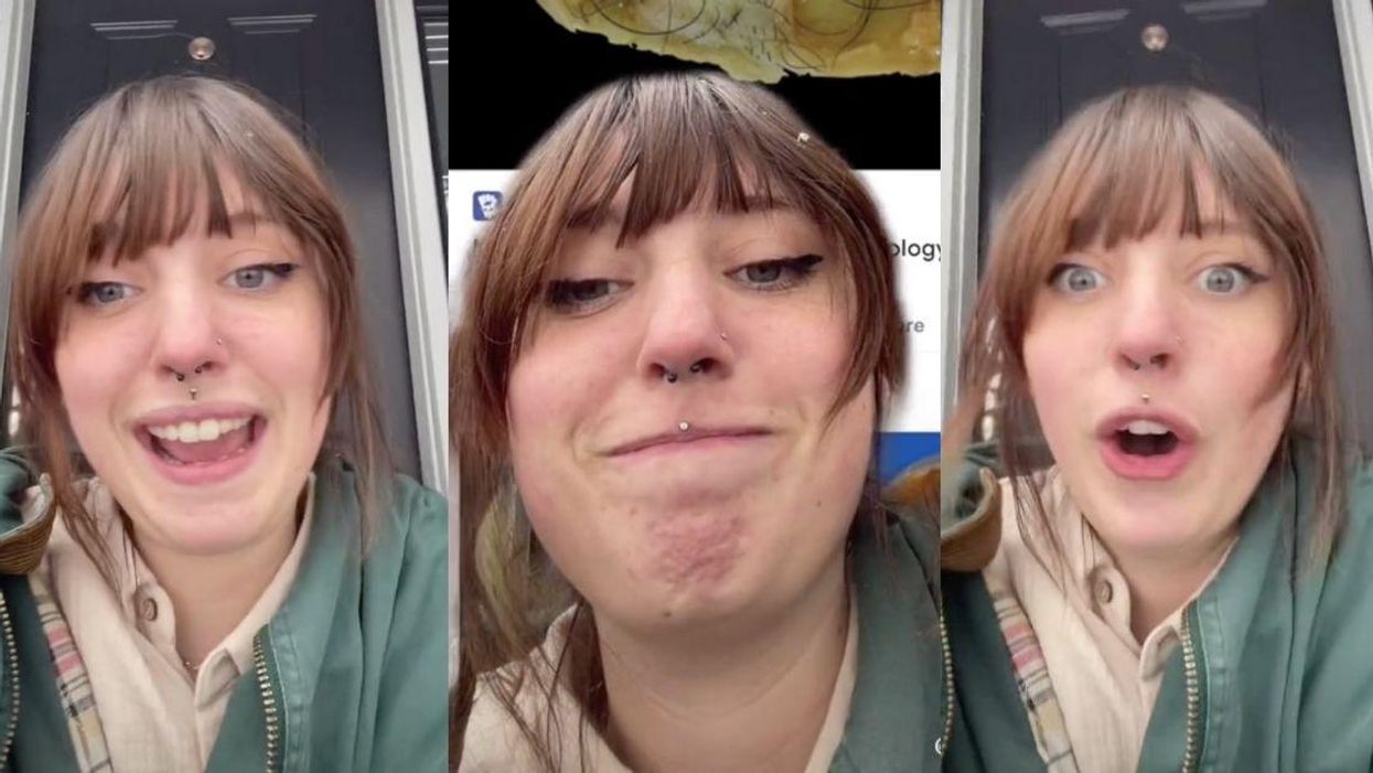 Woman Horrified After Ultrasound Shows She's Had Teeth And Hair Growing In Her Uterus For Two Years