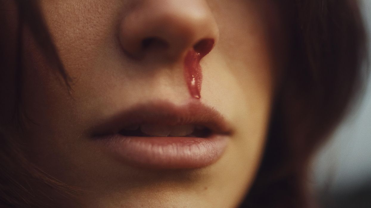 People Describe The Nastiest Thing They've Seen Come Out Of A Human Body