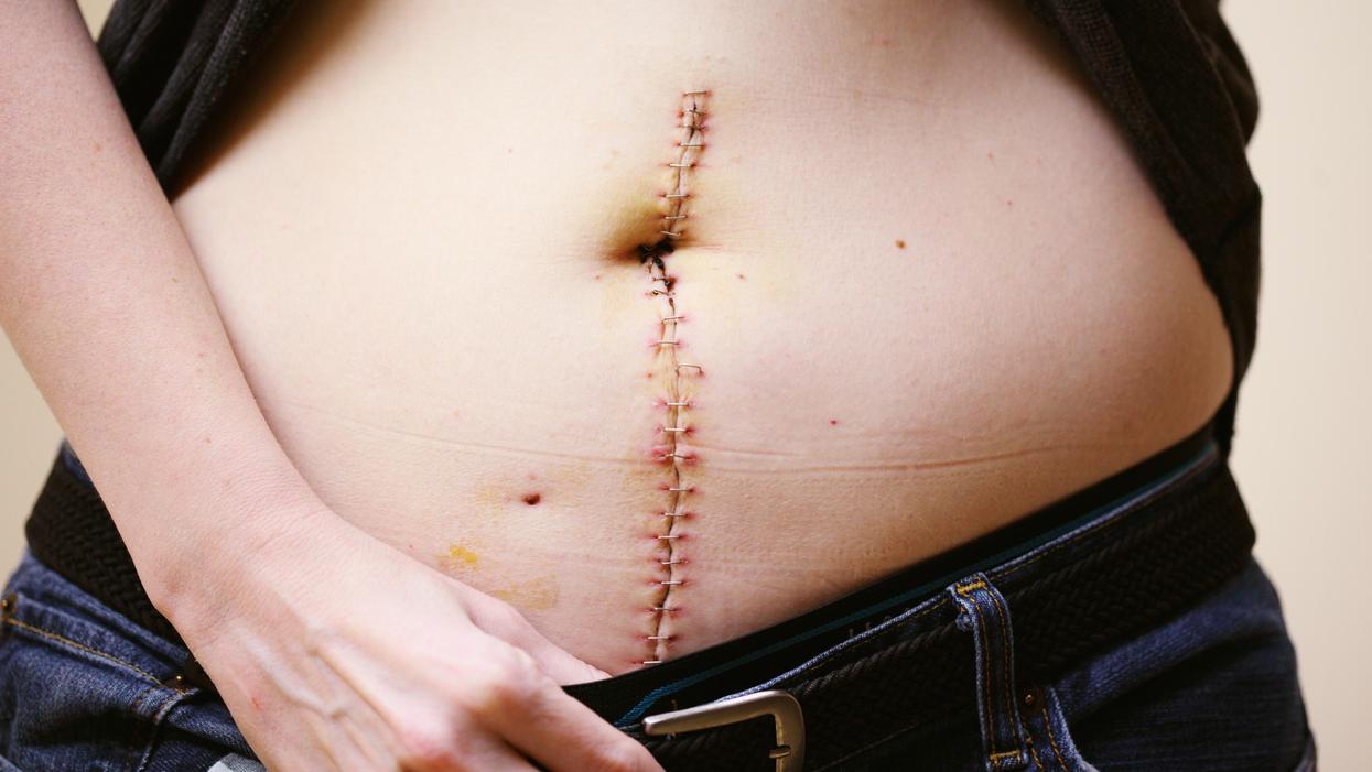 People Explain How They Got Their Most Prominent Scar