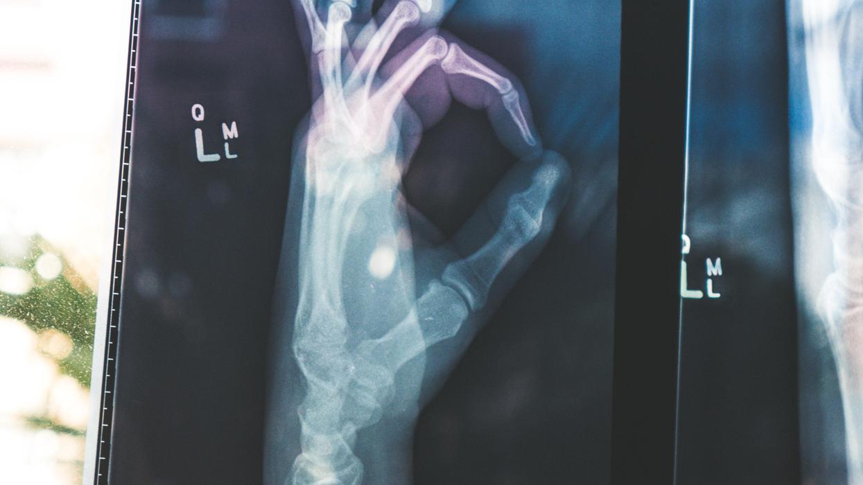 Emergency Room Employees Share The Funniest Reason A Patient Was Brought In