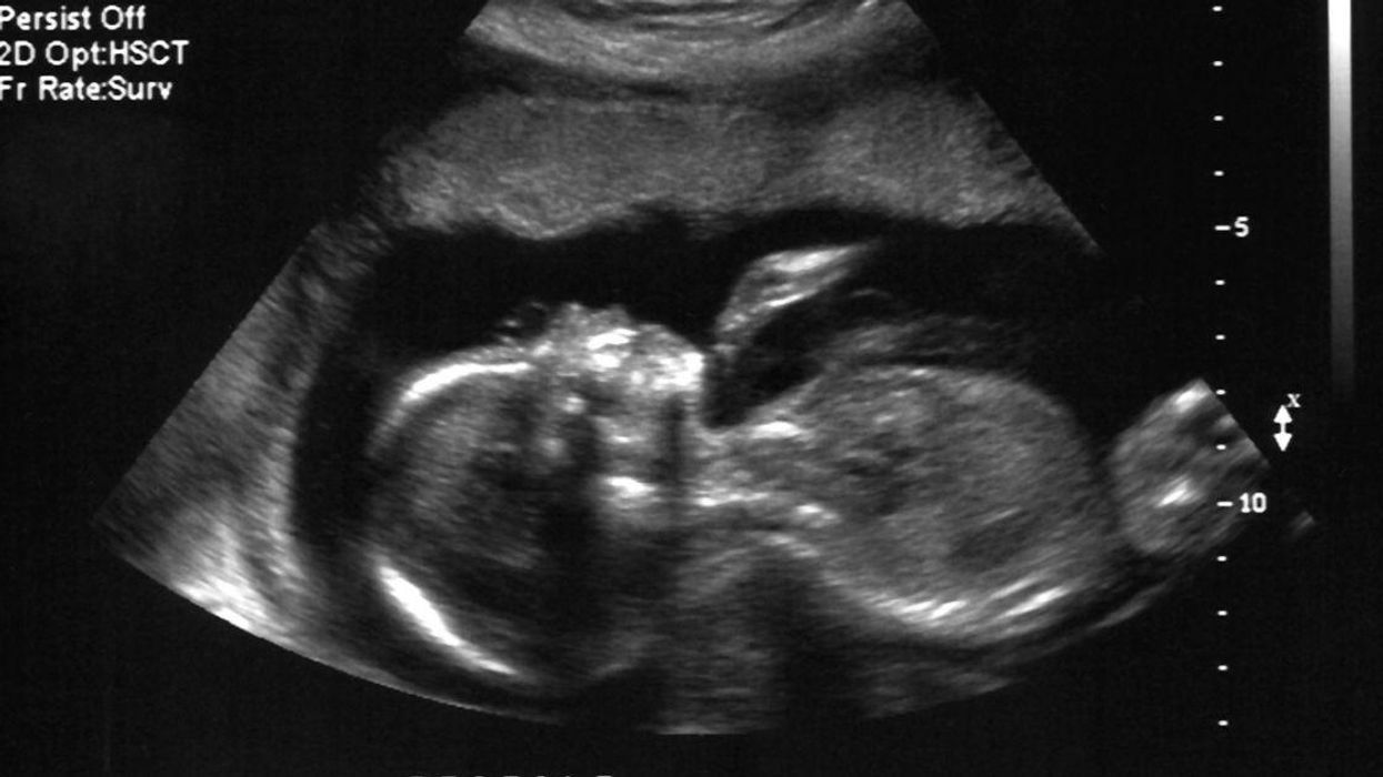 Twitter Troll Proves Anti-Abortionists Are Utterly Clueless With Genius Tweet About Fetuses