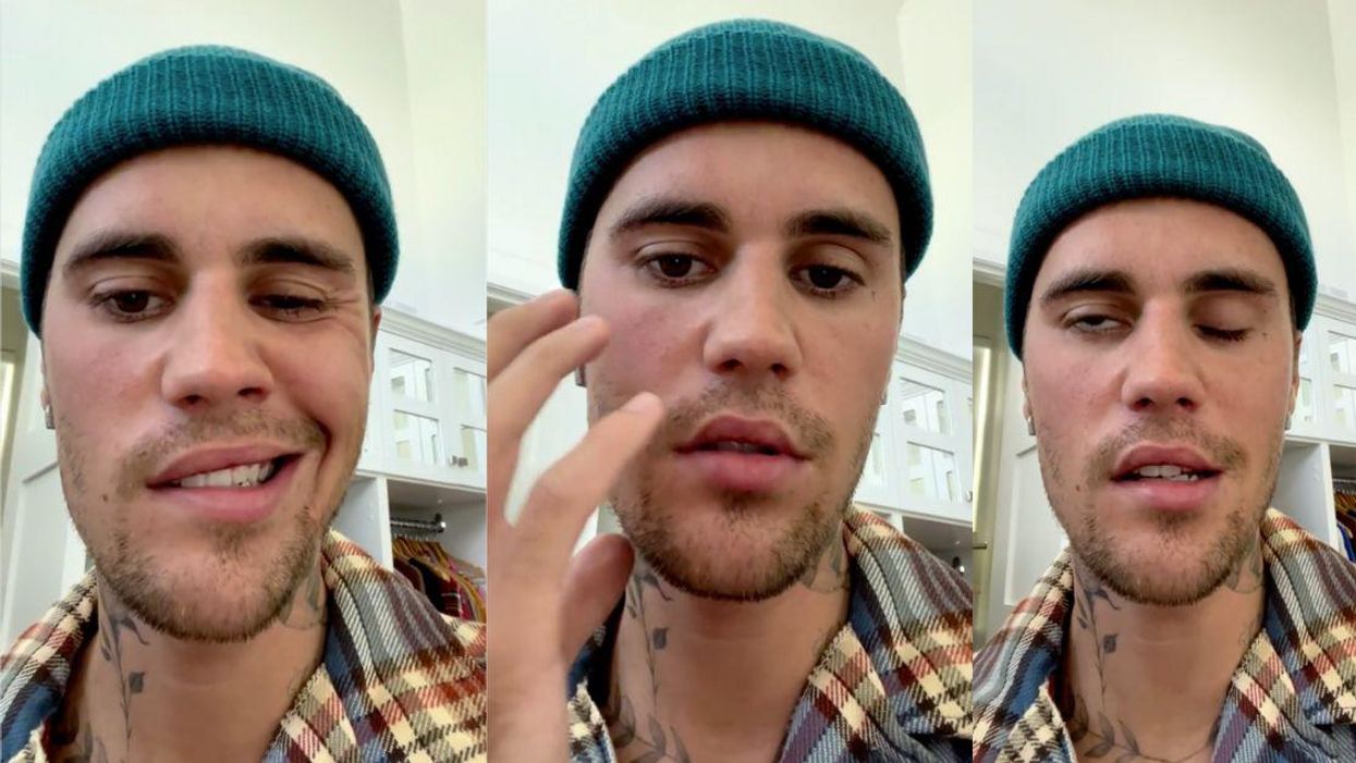 Justin Bieber Flooded With Support After Saying Rare Condition Has Left Half His Face Paralyzed