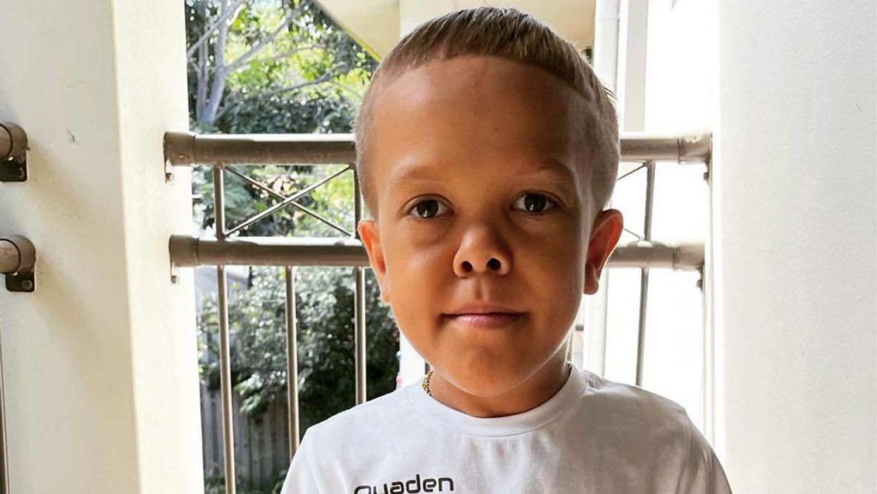 Boy Who Went Viral After Being Bullied For His Dwarfism Lands Role In 'Mad Max' Prequel