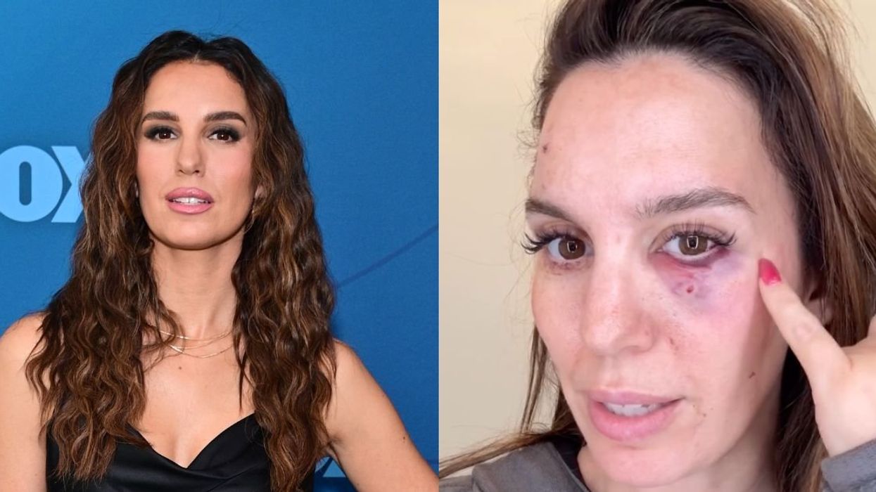 Former Disney Star 'Grateful To Be Alive' After Getting 'Shot In The Eye' At Husband's Birthday Party