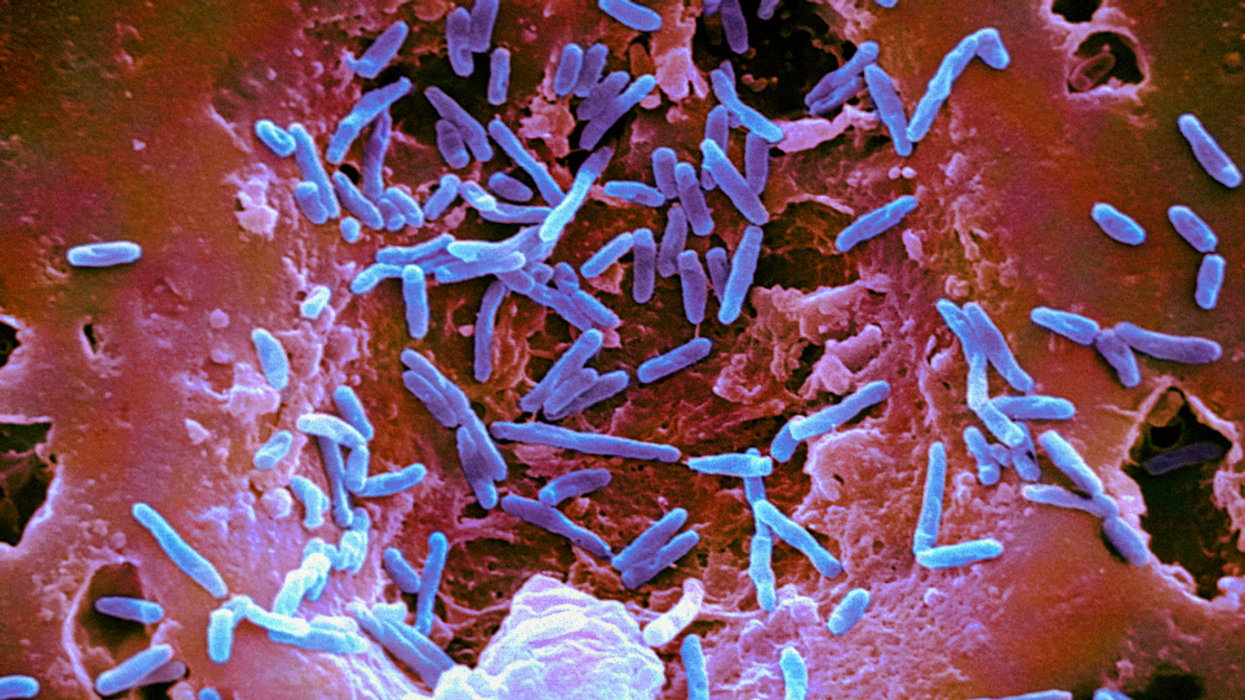 Huge Salmonella Outbreak In 31 States Linked To Kellogg's Honey Smacks