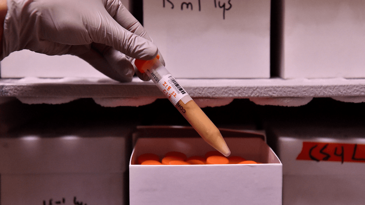 Anonymous People Who Took A DNA Test Reveal What Their Results Said About Them