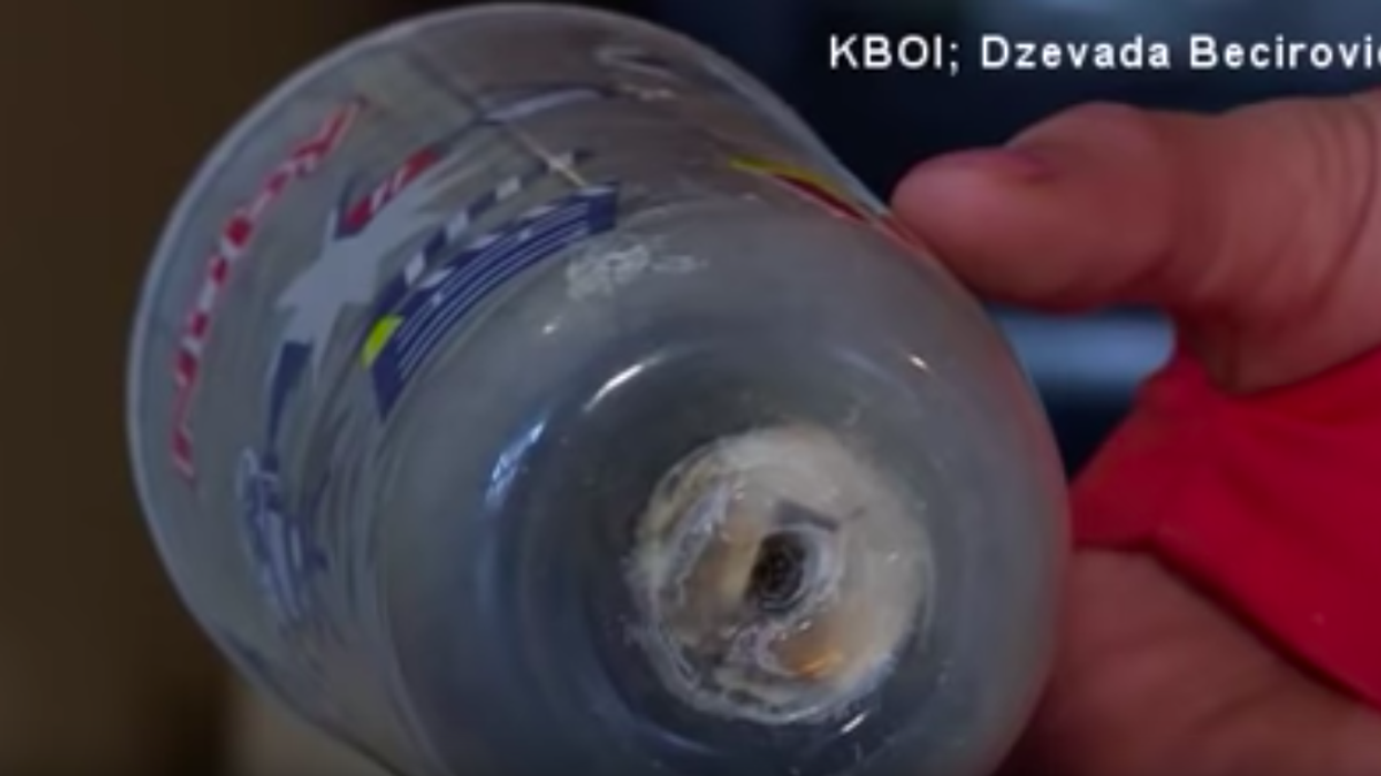 Mom Has Warning For Parents After 1-Year-Old's Sippy Cup Explodes And Sends Her To The Hospital