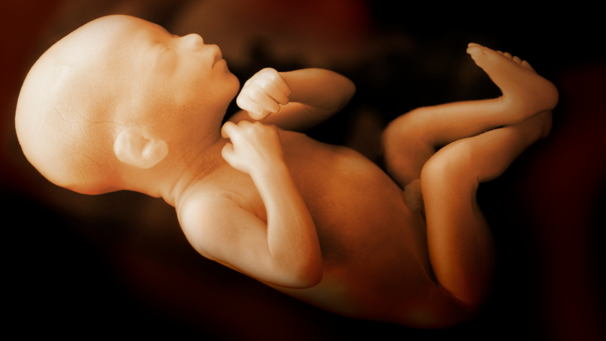 Newborn Baby Gives Doctors A Shock After They Discover Her Twin Is Growing Inside Her Abdomen