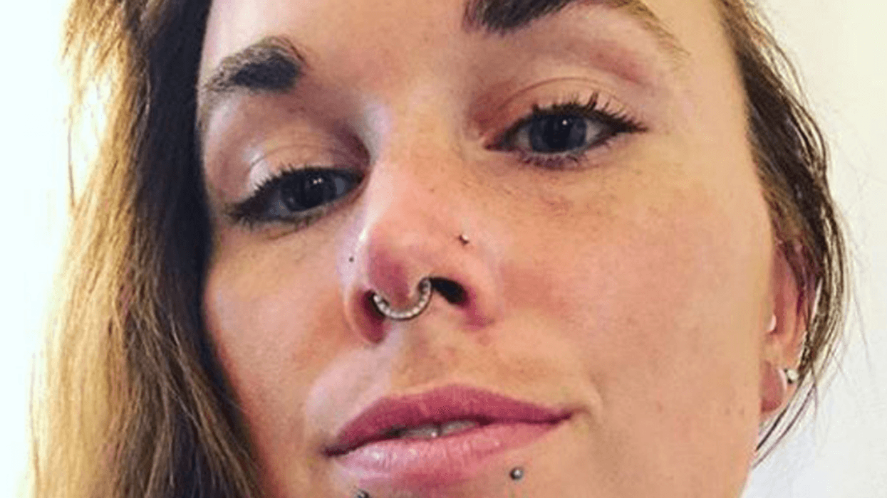 Woman Credits Being Suspended From Metal Hooks For Helping Her Combat Anorexia
