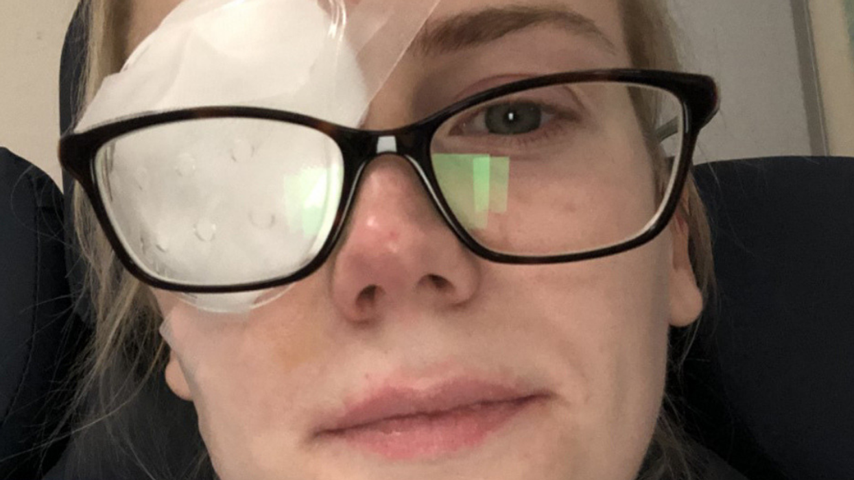 Woman Who Thought She Had A Stray Eyelash In Her Eye Wakes Up Blind Three Days Later
