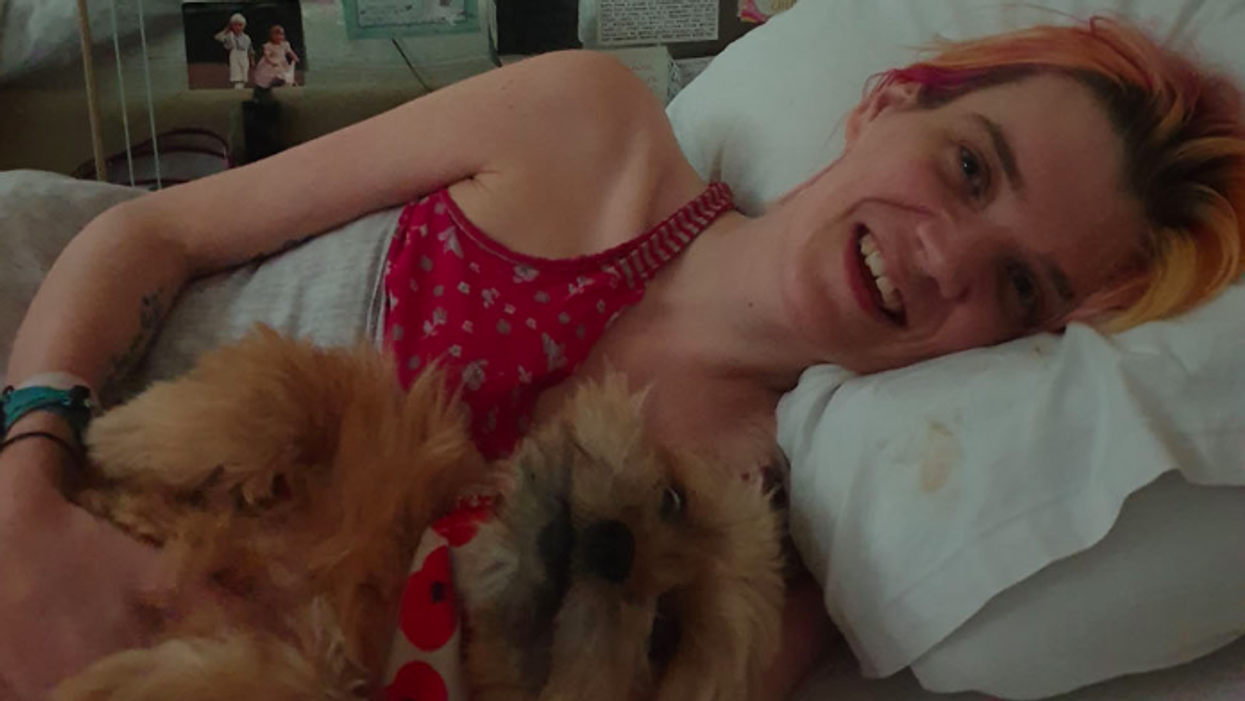 Songwriter's Dreams Of Being A Singer Dashed By Condition That Left Her Extremely Thin