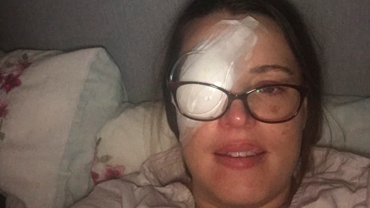 White Dots In Woman's Vision That She Thought Were Laser Pen Prank Turn Out To Be Eye Cancer