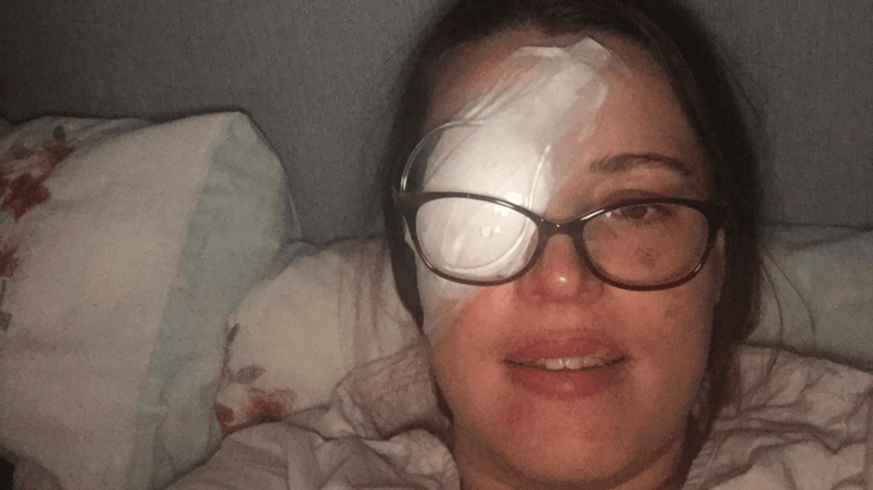 White Dots In Woman's Vision That She Thought Were Laser Pen Prank Turn Out To Be Eye Cancer