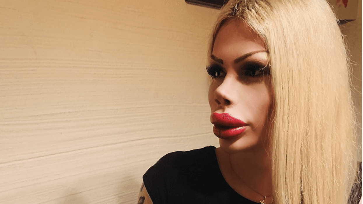 Gender-Neutral Student Who Spent Over $65,000 On Plastic Surgery To Look Like A Doll Hits Back At Critics