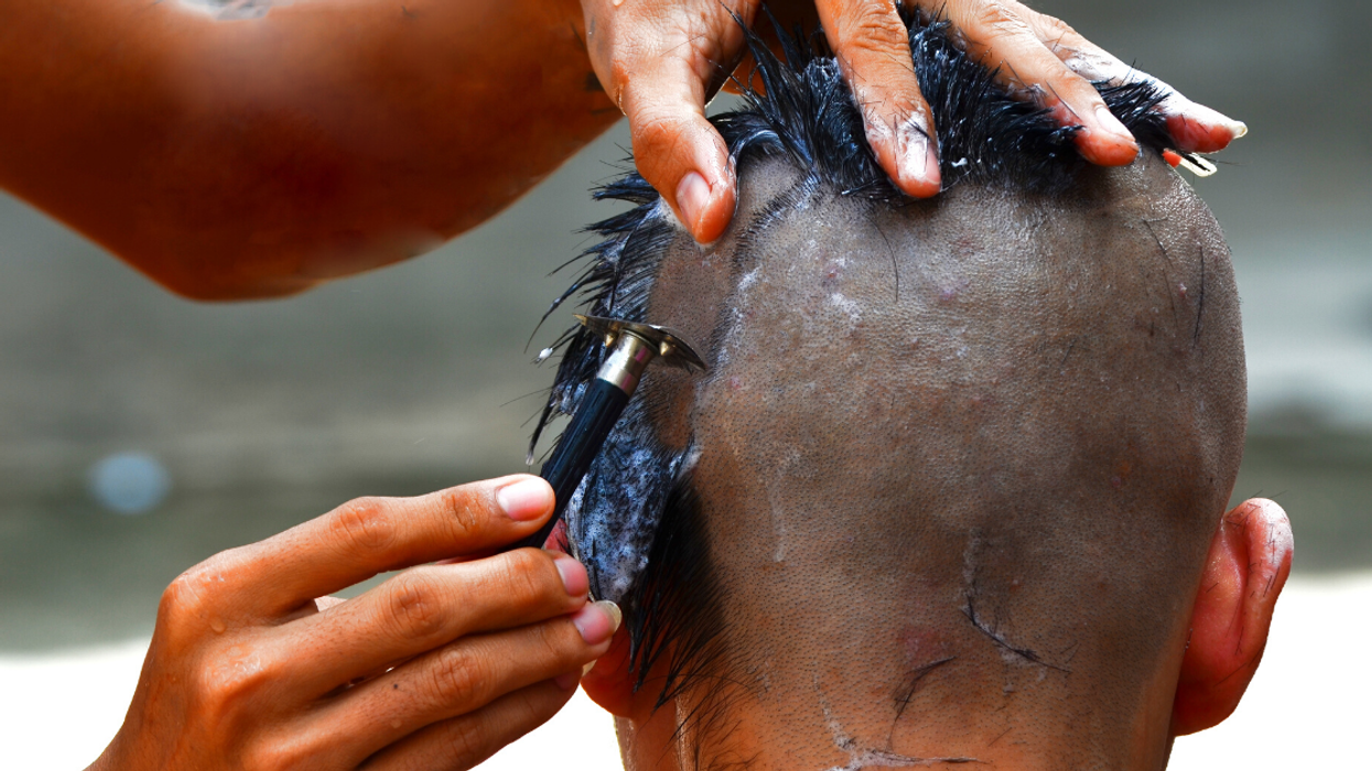 Guy Gets Shamed By Fellow Employees For Refusing To Shave His Head To Support Co-Worker With Cancer
