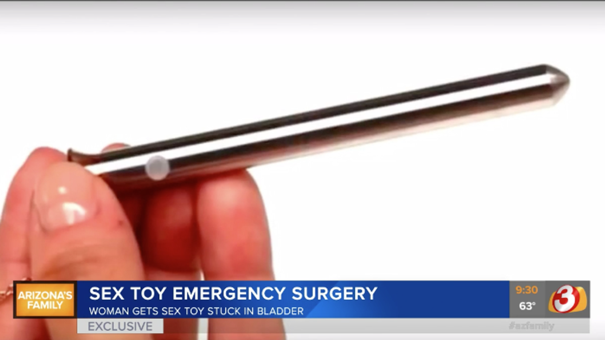 Woman Requires Emergency Surgery After Vibrator Somehow Ends Up In Her Bladder—Still Vibrating