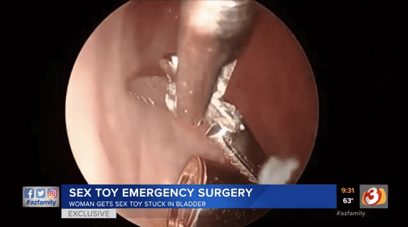 toys for better sex dvd Realistic Middle Finger Dildo Anal Plug