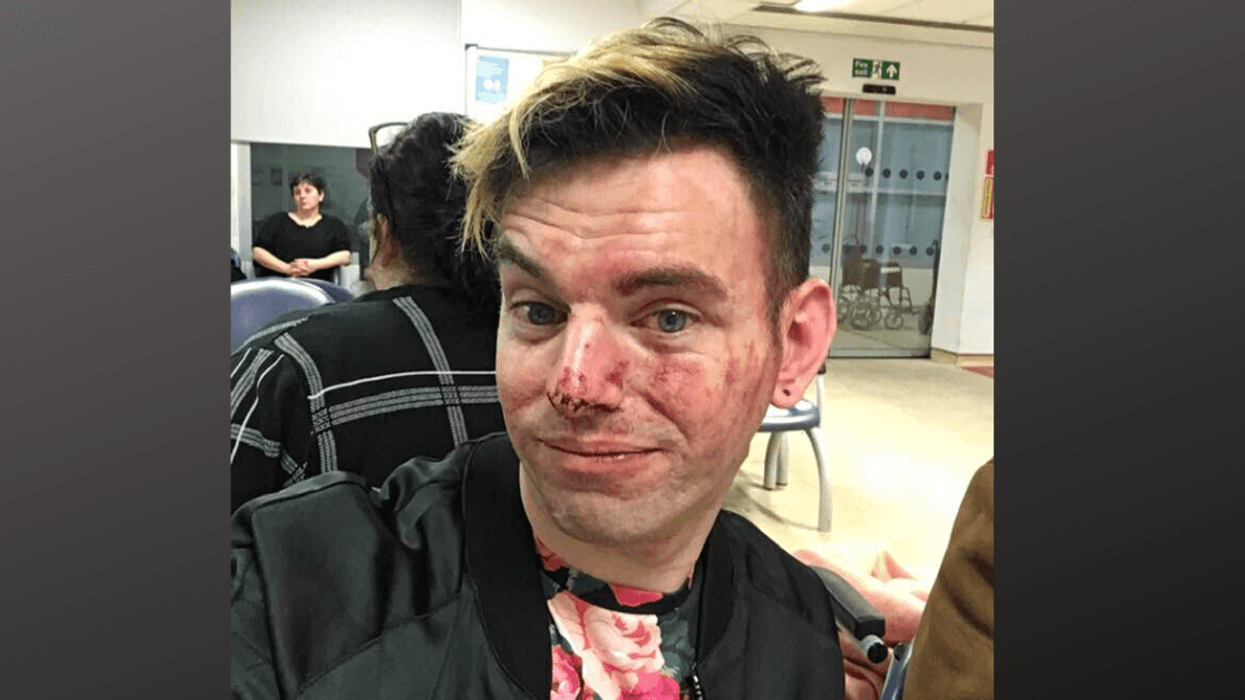 Man Hospitalized After Stepping In To Defend His Two Gay Friends From 'Disgusting' Homophobic Attack