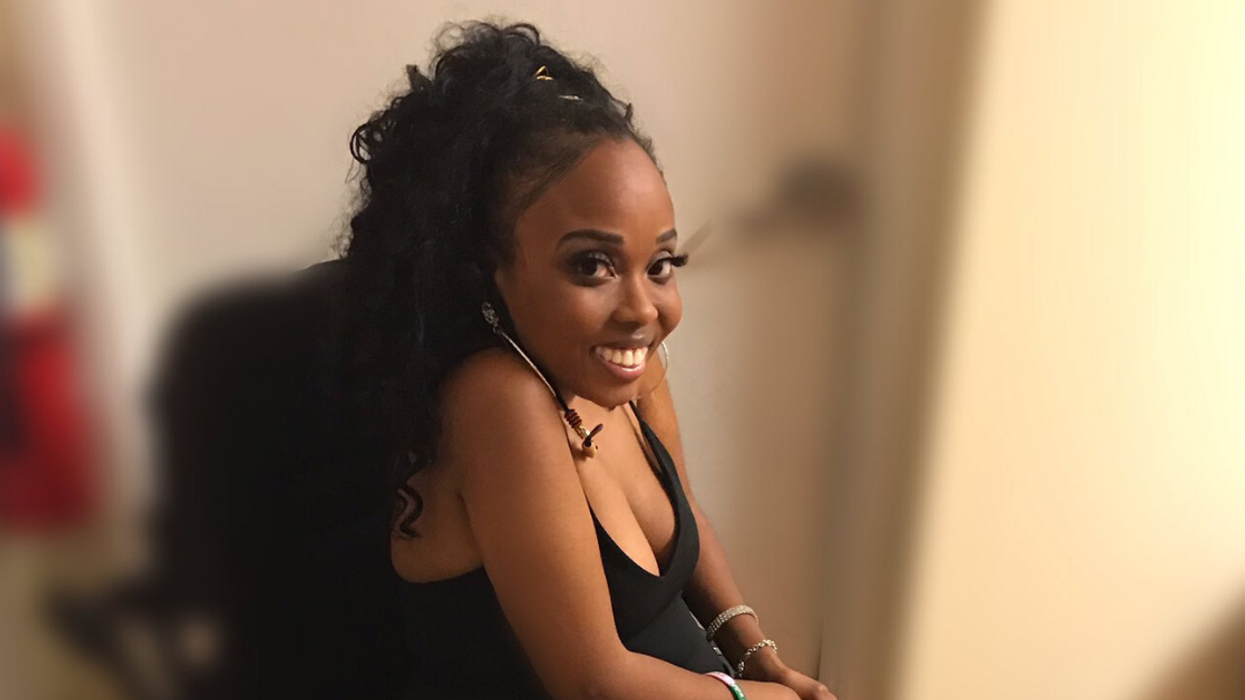 The Internet Comes Through For Woman With Rare Disability Who Avoided Posting 'Sexy' Photos Because She Feared The Negative Comments