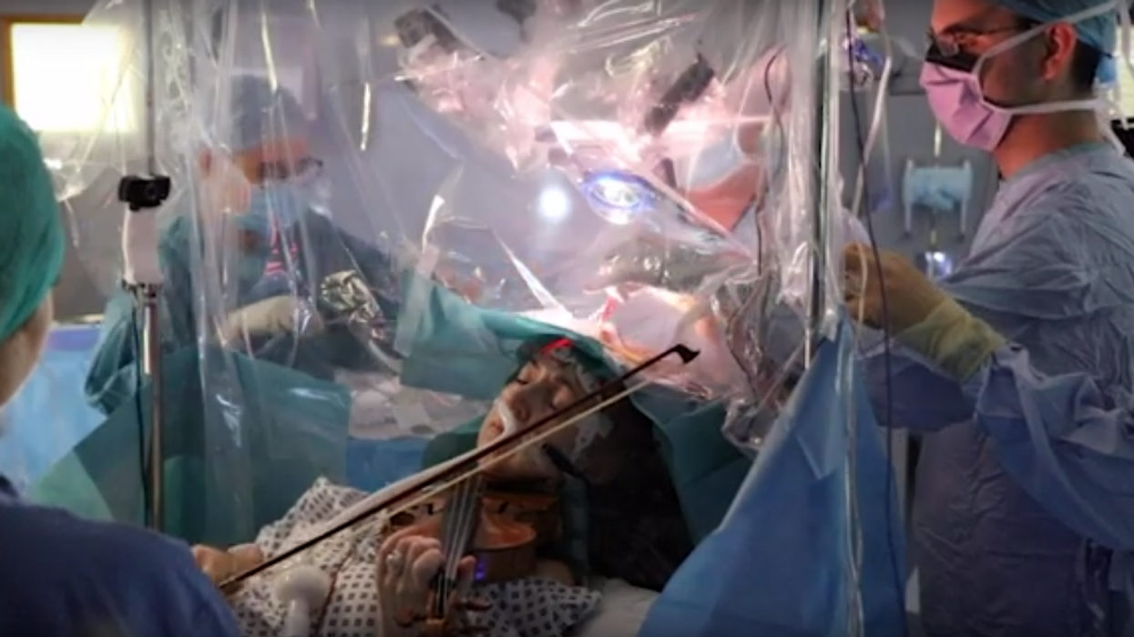 Woman Plays The Violin In Viral Video As Neurosurgeons Remove Tumor From Her Brain