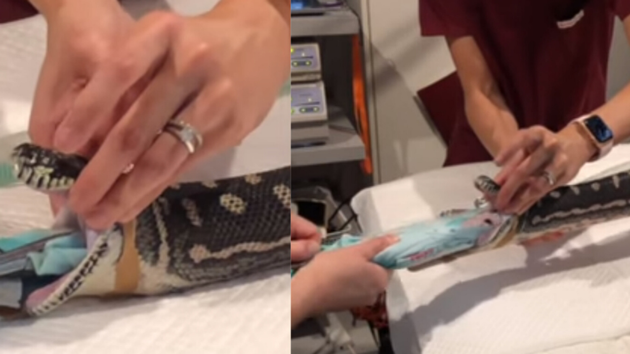 Vet Saves 18-Year-Old Snake's Life In Viral Video After It Ate An Entire Beach Towel