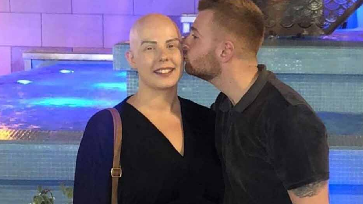 Young Mom Bares Her Bald Head After Alopecia Diagnosis To Give Courage To Her 3-Year-Old Son Who Has The Same Condition