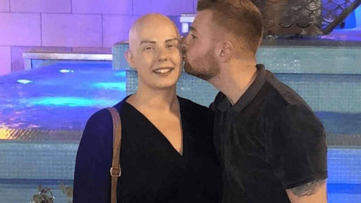 Young Mom Bares Her Bald Head After Alopecia Diagnosis To Give Courage To Her 3-Year-Old Son Who Has The Same Condition